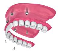 shutterstock_706523173 (1)